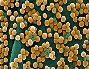 Staphylococcus aureus under a microscope.