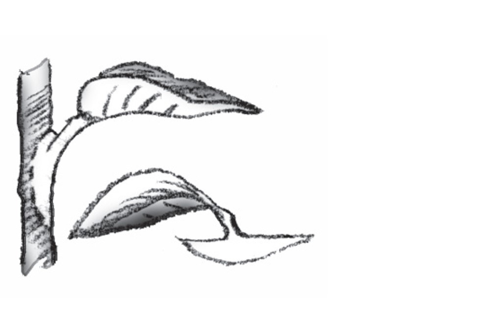 Illustration of heel cutting
