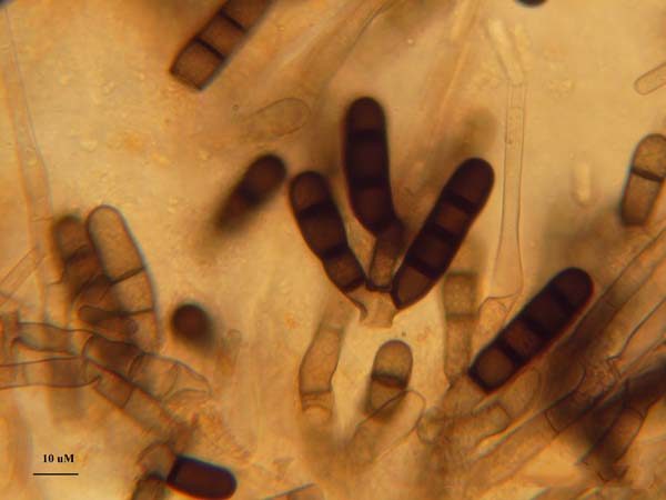 microscopic view of the pathogen depicting various shades of brown cylindrical shapes