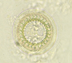 microscope images of Trichodina spp.