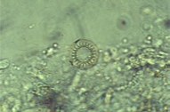 microscope images of Trichodina sp. in skin scrape of fish.