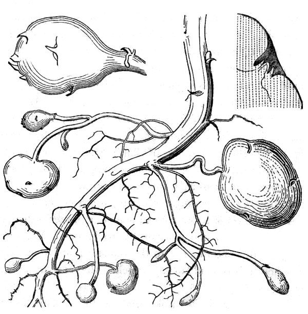 an illustration of tuber of potato