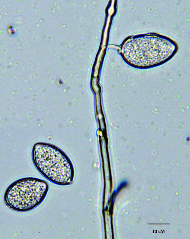Microscopic One lemon-shaped sporangium of Phytophthora infestans on a sporangiophore and two sporangia that have been dislodged.