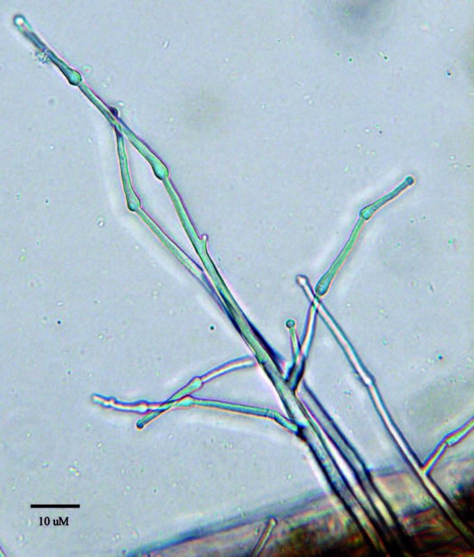 Microscopic Sporangiophores of Phytophthora infestans