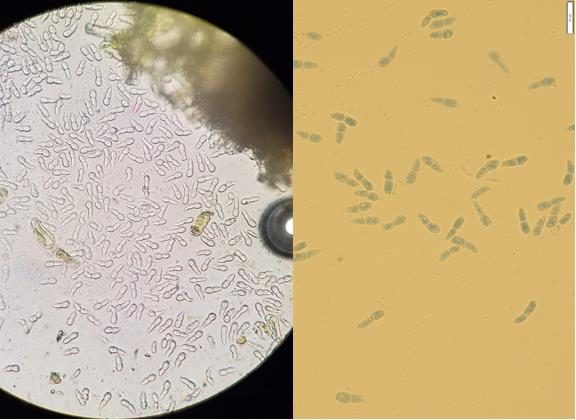 The left picture shows the view of Diplocarpon coronariae spores called conidia under the microscope. The left picture shows the same spores of the D. coronariae fungus stained with blue dye for better contrast.